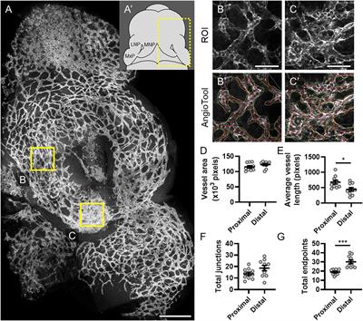 Sonic Hedgehog Signaling in Cranial Neural Crest Cells Regulates Microvascular Morphogenesis in <mark class="highlighted">Facial Development</mark>